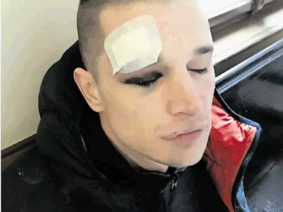 Klemen Rajnar trdi, da so ga policisti ob aretaciji po&scaron;kodovali in nato zasli&scaron;ali, ne da bi prej poklicali zdravnika in odvetnika.