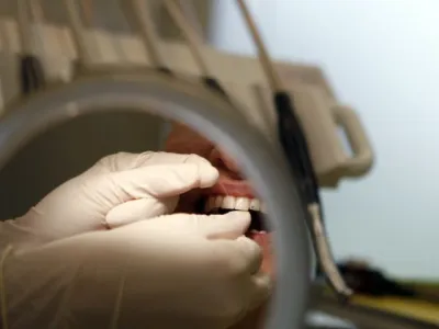 nitkanje zob- Dentalni studio dr. korjanc - Zasebna zobozdravstvena ordinacija - zobozdravstvo - Dunajska 198 v Ljubljani//FOTO: Bojan Velikonja