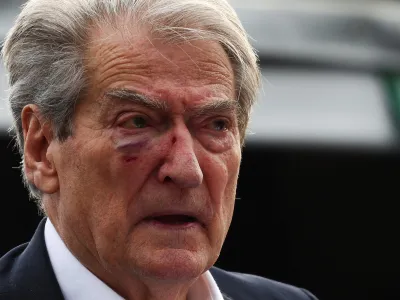 Albania's opposition Democratic Party leader Sali Berisha reacts after being punched in the face by a protestor, as the EU-Western Balkans summit takes place in Tirana, Albania, December 6, 2022. REUTERS/Florion Goga