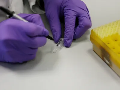 gen DEPTOR, ki vpliva na debelost - Laboratorij za biotehnologijo - Kemijski in&scaron;titut//FOTO: Tomaž Skale