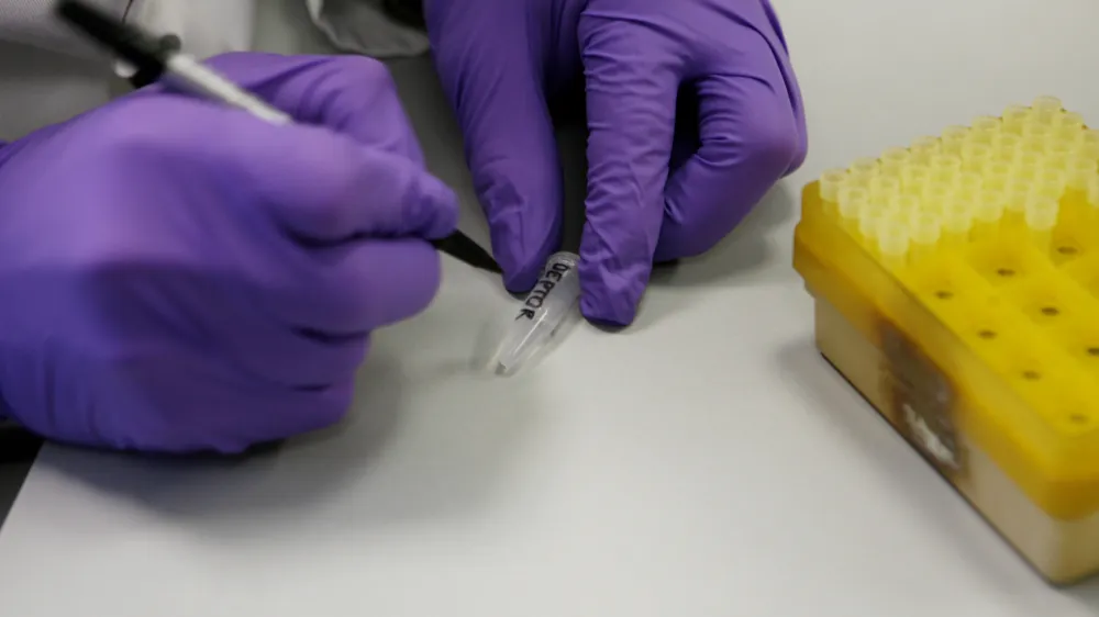 gen DEPTOR, ki vpliva na debelost - Laboratorij za biotehnologijo - Kemijski in&scaron;titut//FOTO: Tomaž Skale