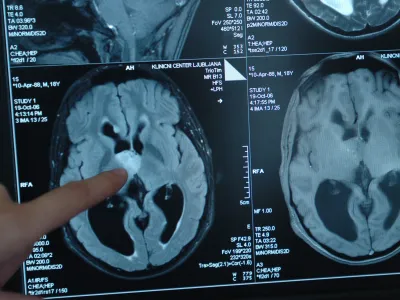 aparat za slikanje z magnetno resonanco magnetom trio (3T), - Klinični center Ljubljana (KC) - Klinični in&scaron;titut za radiologijo &ndash; tumor v možganih <br><br><br>,//FOTO: Matej Pov&scaron;eOPOMBA: ZA OBJAVO V ČASOPISU DNEVNIK