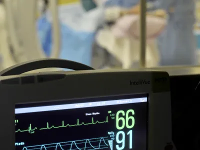 - ilustrativna fotografijazdravstvo, zdravstvene preiskave, zdravstveni pregled, radiologija, bolni&scaron;nica, zdravje, merjenje vitalnih znakov, medicina- Klinični in&scaron;titut za radiologijo UKC v Ljubljani ob mednarodnem dnevu radiologije predstavili nove metode zdravljenja;//FOTO: Tomaž Zajel&scaron;nik