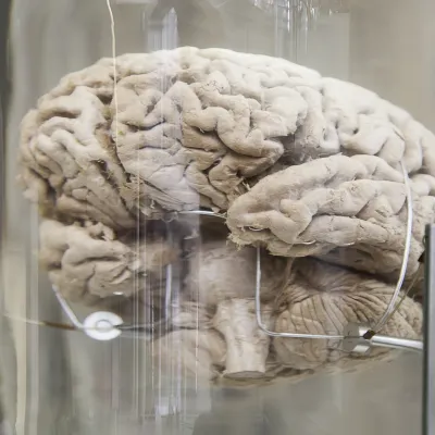 Human brain, detail of a human organ, intelligence and thought