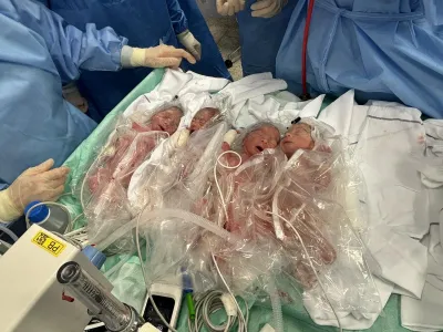 Roditev četverčkov