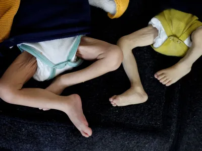 Palestinske otroke, ki trpijo zaradi podhranjenosti in vsesplo&scaron;ne lakote v Gazi, so odpeljali na zdravljenje v zdravstveni center v Rafi. Foto: Reuters