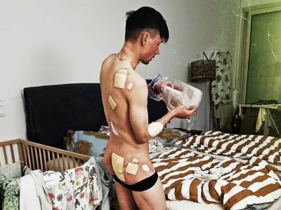 Primož Roglič je na 3. in 4. etapi Dirke po Baskiji utrpel hude odrgnine.