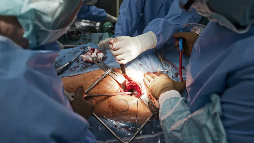 Operacija kolka, dr. Rasto Stok in dr. Peter Pavlov&Auml;Ťi&Auml;ŤFOTO: JAKA GASAR / NEDELJSKI