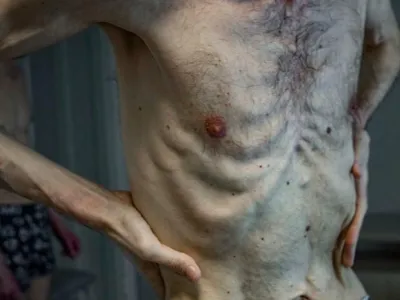 Fotografije zapornika so ob&scaron;le svet.