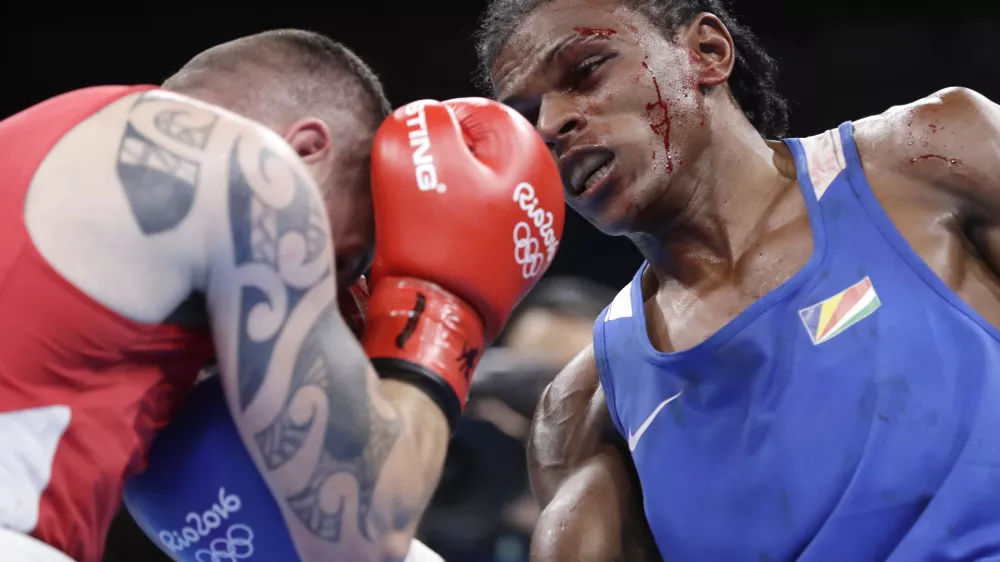 Seychelles' Andrique Allisop, right, fights Ireland's David Joyce during a men's lightweight 60-kg preliminary boxing match at the 2016 Summer Olympics in Rio de Janeiro, Brazil, Sunday, Aug. 7, 2016. (AP Photo/Frank Franklin II)