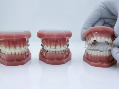 Pri načrtovanih zdravljenjih v tujini je posebej veliko storitev s področja zobozdravstva: ortodontskih, kjer gre za zdravljenje zobnih in čeljustnih nepravilnosti, in endodontskih, kjer bolniki med drugim potrebujejo zdravljenje zobnih korenin. Foto: Jaka Gasar