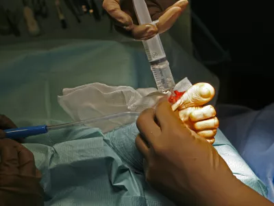 Prebivalci ob zadržanih pravicah ostanejo brez dostopa do &scaron;tevilnih zdravljenj. Fotografija je simbolična. Foto: Tomaž Skale