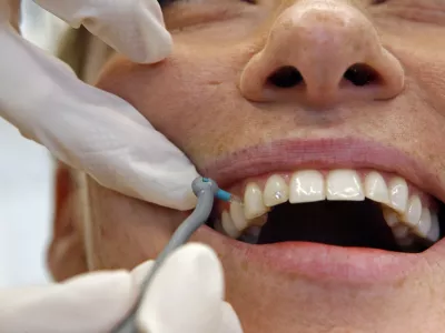 medzobna &scaron;četkanje - ilustrativna fotografija - Dentalni studio dr. &Scaron;korjanc - Zasebna zobozdravstvena ordinacija - zobozdravstvo - Dunajska 198 v Ljubljani//FOTO: Bojan Velikonja