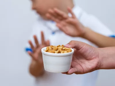 Peanut food allergy concept. Great concept of allergy and skin diseases. Nut allergies. No peanuts. Food allergy symptoms, Irritation