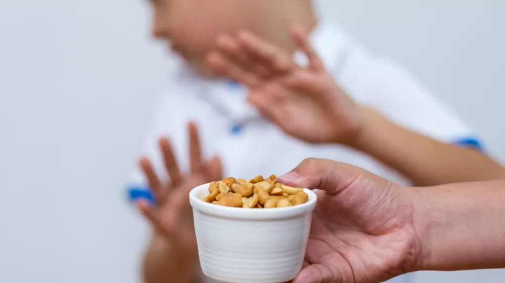 Peanut food allergy concept. Great concept of allergy and skin diseases. Nut allergies. No peanuts. Food allergy symptoms, Irritation