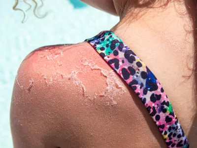 Slika je simbolična. / Foto: Istock