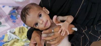 Seela Barbakh, an 11-month-old Palestinian girl who is malnourished, according to medics, is held by her mother, Najah, at Nasser Hospital in Khan Younis, in the southern Gaza Strip, July 23, 2025. REUTERS/Ramadan Abed