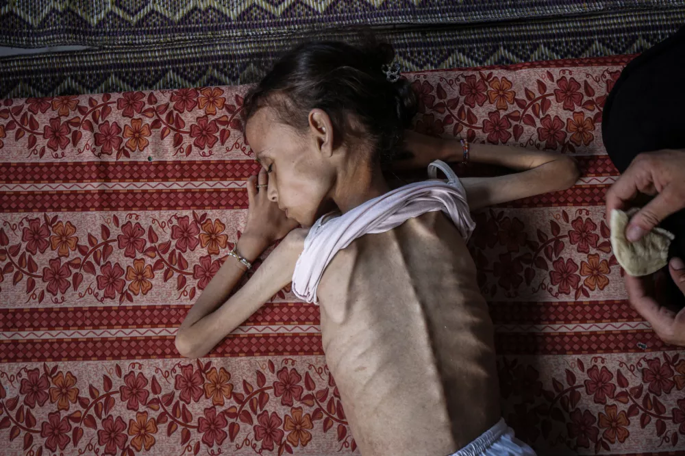 FILED - 31 July 2025, Palestinian Territories, Gaza: Palestinian 9-years-old girl Maryam Abdulaziz Mahmoud Davvas, lies by the feet of her mother after she became unable to walk due to severe malnutrition caused by Israel's blockade on Gaza City. Photo: Omar Ashtawy/APA Images via ZUMA Press Wire/dpa