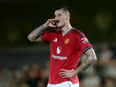Soccer Football - Carabao Cup - Second Round - Grimsby Town v Manchester United - Blundell Park, Grimsby, Britain - August 27, 2025 Manchester United's Benjamin Sesko Action Images via Reuters/Lee Smith EDITORIAL USE ONLY. NO USE WITH UNAUTHORIZED AUDIO, VIDEO, DATA, FIXTURE LISTS, CLUB/LEAGUE LOGOS OR 'LIVE' SERVICES. ONLINE IN-MATCH USE LIMITED TO 120 IMAGES, NO VIDEO EMULATION. NO USE IN BETTING, GAMES OR SINGLE CLUB/LEAGUE/PLAYER PUBLICATIONS. PLEASE CONTACT YOUR ACCOUNT REPRESENTATIVE FOR FURTHER DETAILS..