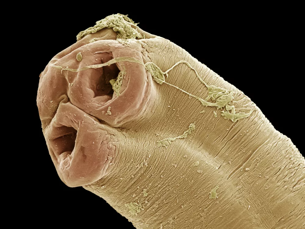 Cobra tapeworm. Coloured scanning electron micrograph (SEM) of the head (scolex) of a cobra tapeworm (Taenia sp.). Tapeworms are parasites that inhabit the intestines of animals and humans. Different tapeworms have different animals as their intermediate and final hosts. The suckers (round) help to anchor the worm to the host's intestinal lining. Tapeworms do not possess a digestive tract and so absorb nutrients from the half-digested food of the host through their skin.,Image: 103049808, License: Rights-managed, Restrictions:, Model Release: no / Foto: Profimedia