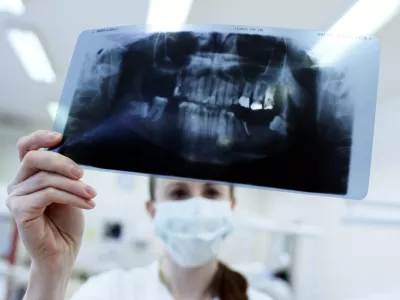 Ortopanska slika- Stomatolo&scaron;ka klinika UKC Ljubljana - zobozdravstvo//FOTO: Jaka Adamič