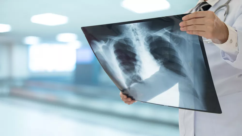 Zdravniki so uporabili vse, kar so imeli na voljo. Slika je simbolična. / Foto: Istock