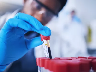 Science, blood and hands with test tube in laboratory for research, medical exam and sample analysis. Healthcare, pharmaceutical and black man scientist with vial for dna experiment, rna and genetics / Foto: Jacob Wackerhausen