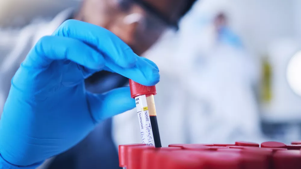Science, blood and hands with test tube in laboratory for research, medical exam and sample analysis. Healthcare, pharmaceutical and black man scientist with vial for dna experiment, rna and genetics / Foto: Jacob Wackerhausen