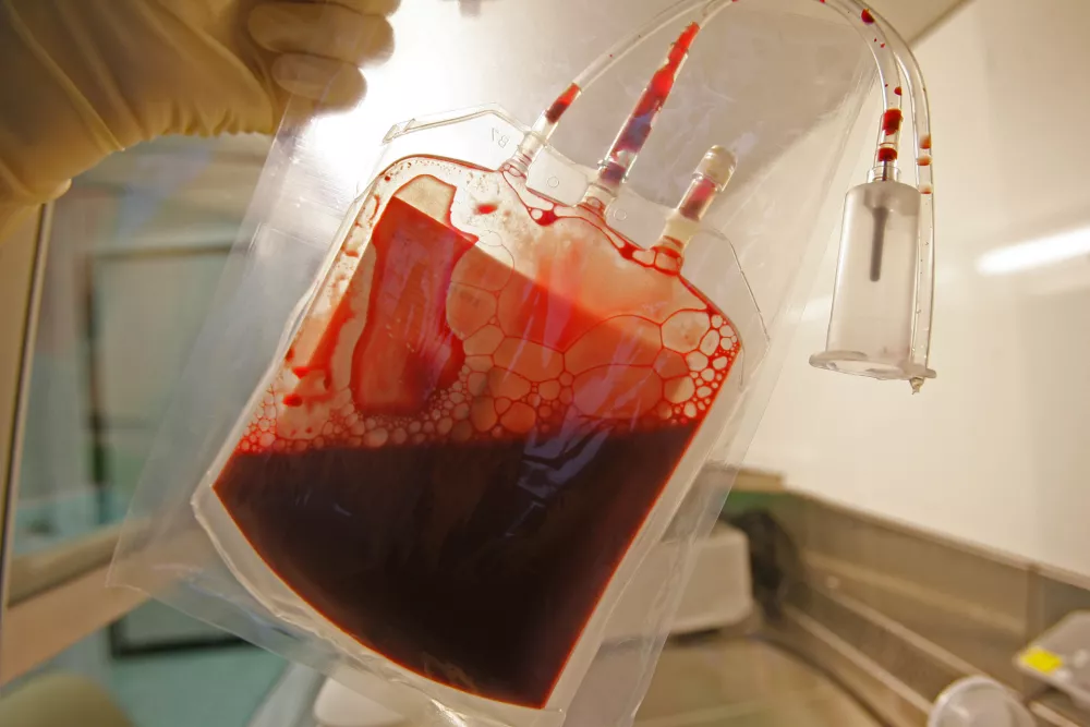 Matične celice iz popkovnice - matične celice iz popkovnične krvi imajo velik potencial za zdravljenje bolezni v prihodnosti - nastanejo ob spočetju in so temelj življenja - to so nerazvite osnovne celice, ki se lahko pod določenimi pogoji razvijejo v katerokoli celico, npr. v mi&scaron;ice, živčevje ali drugo tkivo v telesu. Nekatere pa se ne specializirajo, temveč opravljajo nalogo regeneracije tkiva.- Zavod RS za transfuzijsko medicino - //FOTO: Matej Pov&scaron;eOPOMBA: ZA OBJAVO V ČASOPISU DNEVNIK / Foto: Matej Pov&scaron;e