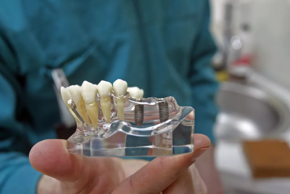 H-Dent Stomatolo&scaron;ka ordinacija Habijanec- Hrva&scaron;ka 2012 - Rovinj - dentalni turizem - popravilo zob - cenej&scaron;i zobozdravniki na hrva&scaron;kem - //FOTO: Bojan Velikonja OPOMBA: ZA OBJAVO V PRILOGI &ndash; DNEVNIKOV OBJEKTIV - REPORTAŽA 2012