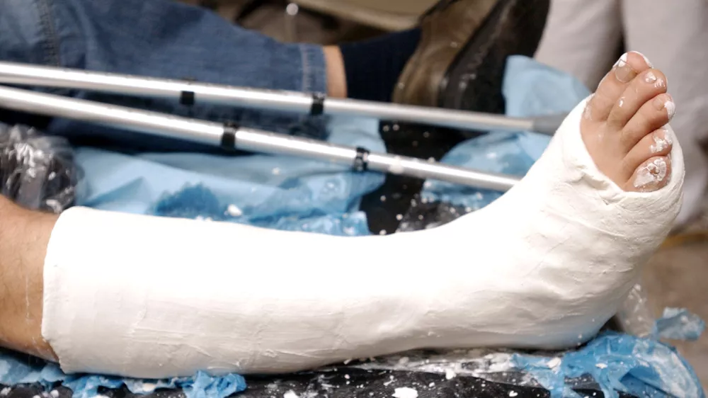 Bolni&scaron;ka odsotnost: Kako bo videti laični nadzor in kaj skrbi detektive?