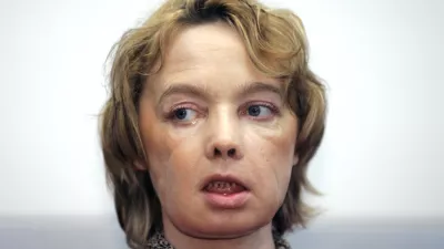 Isabelle Dinoire, the woman who received the world's first partial face transplant with a new nose, chin and mouth, in an operation on Nov. 27, 2005, addresses reporters during her first press conference since the transplant at the Amiens hospital, northern France Monday Feb. 6, 2006. The 38-year-old woman was mauled by a dog in May, leaving her with severe facial injuries that her doctors said made it difficult for her to speak and eat. (AP Photo/Michel Spingler)