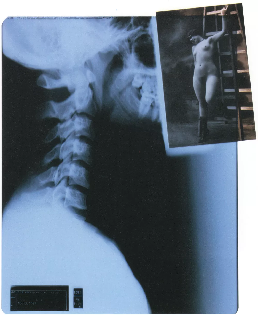 Stane Jagodič: Želja; rentgenska umetnost, fotomontaža, 40 x 30 cm (1996) F arhiv MGL