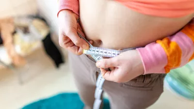 Smernice debelost nedvoumno opredeljujejo kot kronično bolezen in ne kot posledico pomanjkanja volje / Foto: Getty Images