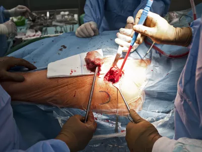 Koliko delajo zdravniki? Že zdaj bi morali spremljati obremenitve zaposlenih