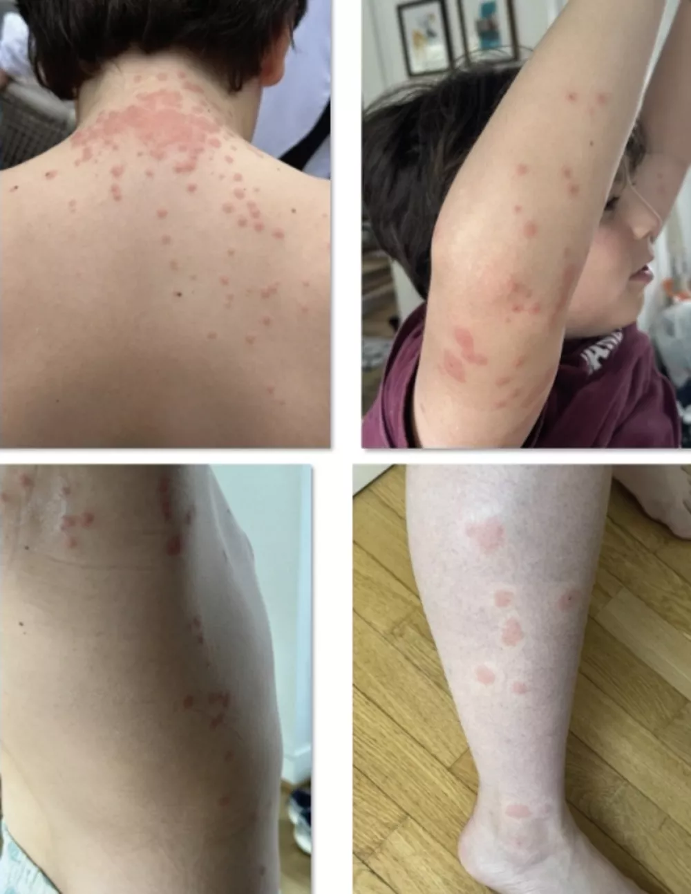 Fotografija posledic / Foto: Exyuaviation.com