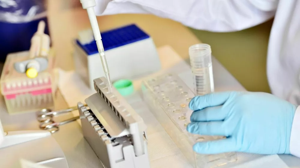 analiza DNK v laboratoriju