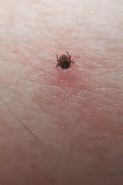 Tick Ixodes ricinus on human skin. tick wandering over human hand. Encephalitis tick