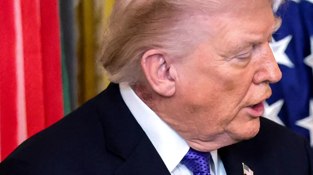 FILE PHOTO: A patch of blemished skin is visible over U.S. President Donald Trump's shirt collar during a Medal of Honor ceremony at the White House in Washington, D.C., U.S., March 2, 2026. REUTERS/Jonathan Ernst/File Photo